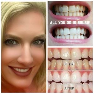 Whitening Toothpaste